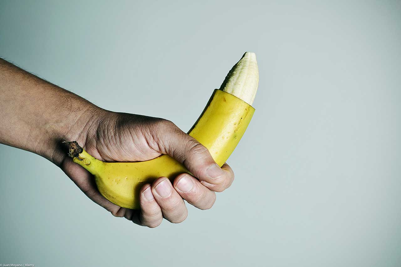 FRENULO CORTO, FRENULECTOMIA, FRENULOPLASTICA E CIRCONCISIONE