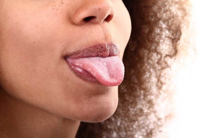 bambini febbre alta lingua bianca bambini febbre alta lingua bianca