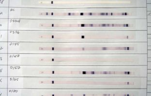 DISPERATA E LOGORATA DAL DUBBIO SULLA VERIDICITÀ DEL TEST HIV